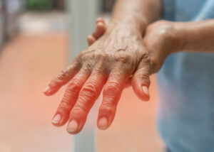 What Is Neuropathy - N8 Family Chiropractic What Is Neuropathy