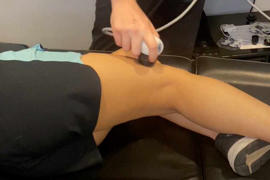 shockwave therapy ohio thigh